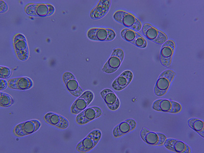 Tanti dubbi (Heteroradulum deglubens)